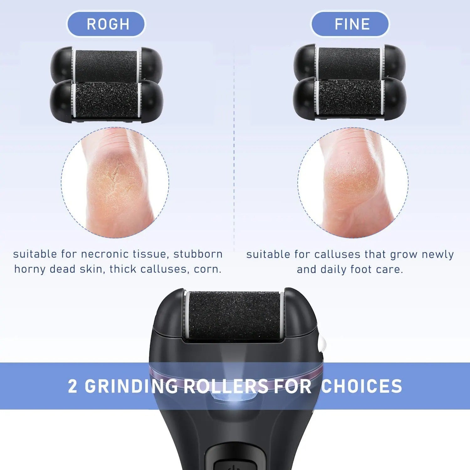 SmoothFeet Electric Pedicure Tool